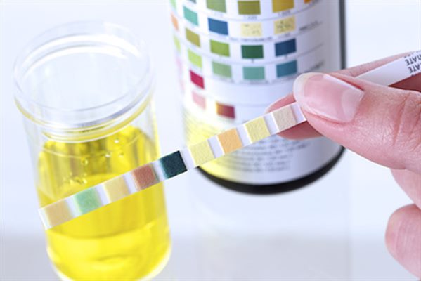 Changement de couleur des urines
