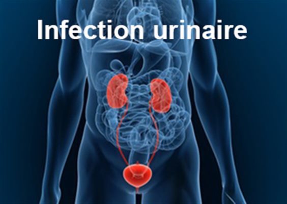 infecția urinara)