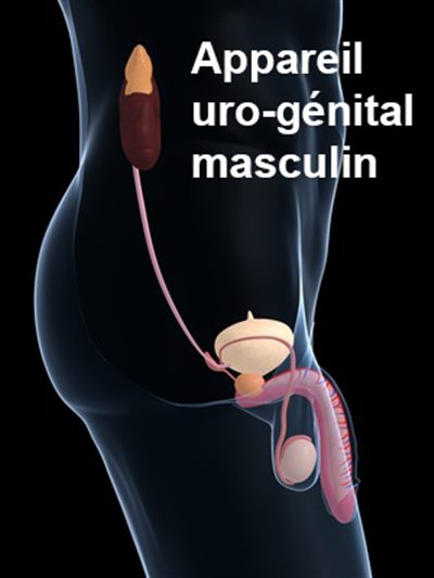 Troubles urinaires/sexuels chez l'homme et syndrome métabolique