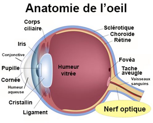 Névrite optique