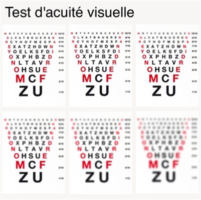 Troubles visuels : symptômes, traitement, définition - docteurclic.com