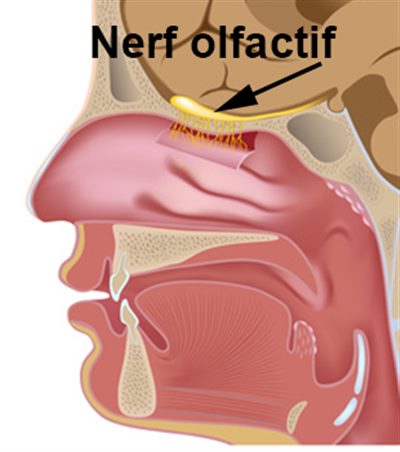 Odorat: Anosmie