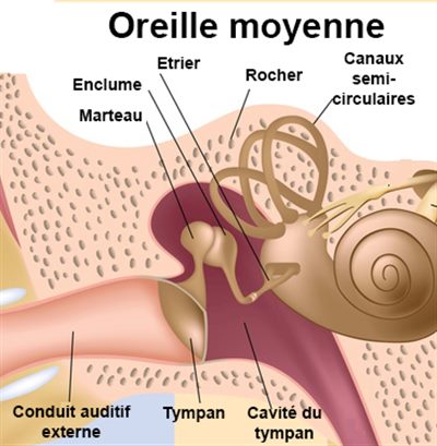 Barotraumatismes de l'oreille moyenne en plongée