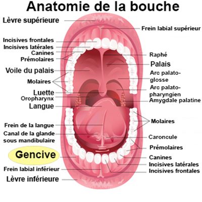 Gencives gonflées