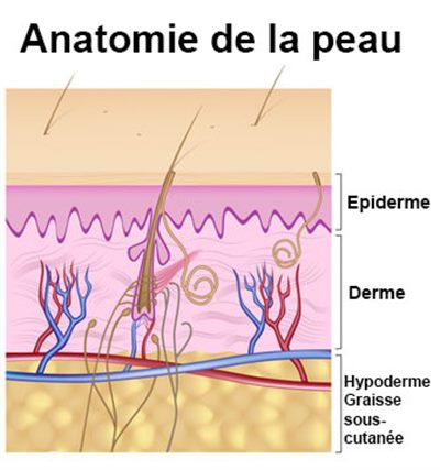 Que faire en cas de brûlure cutanée thermique ?