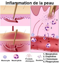 inflammation de la peau