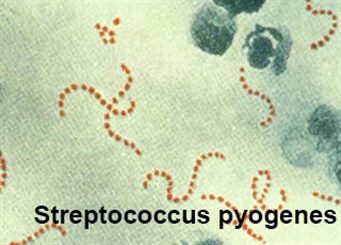 streptococcus pyogenes