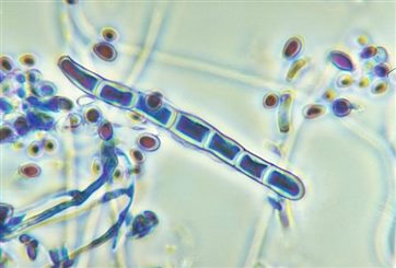 trichophyton