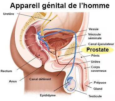 problème de prostate chez l homme