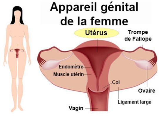 Malformations utérines