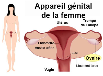 Kyste de l'ovaire : symptômes, traitement, définition ...