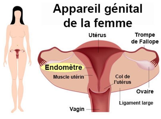 Endométriose : symptômes, traitement, définition - docteurclic.com