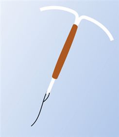 stérilet au cuivre