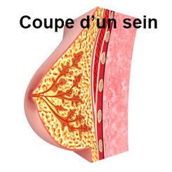 coupe du sein
