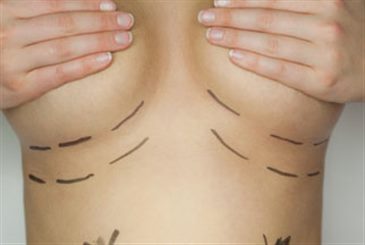chirurgie des seins