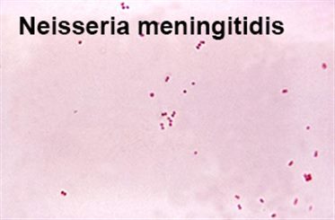 neisseria meningitidis