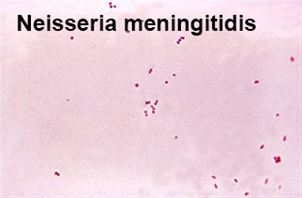Infections invasives à méningocoque (IIM)