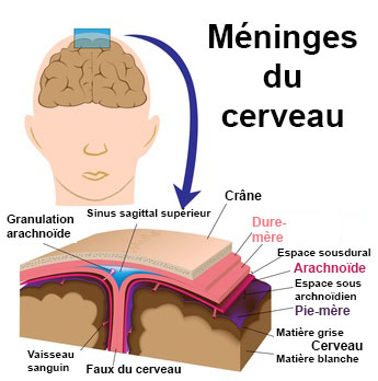 Méningiome : symptômes, traitement, définition Méningiome : symptômes, traitement, définition