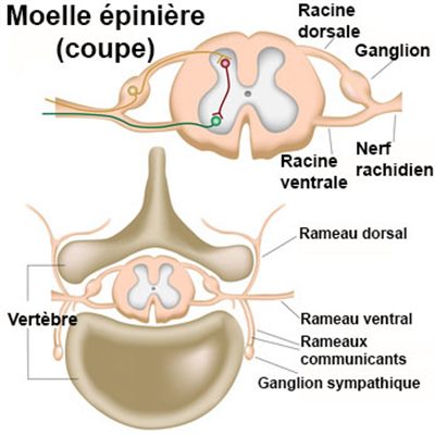 Myélographie