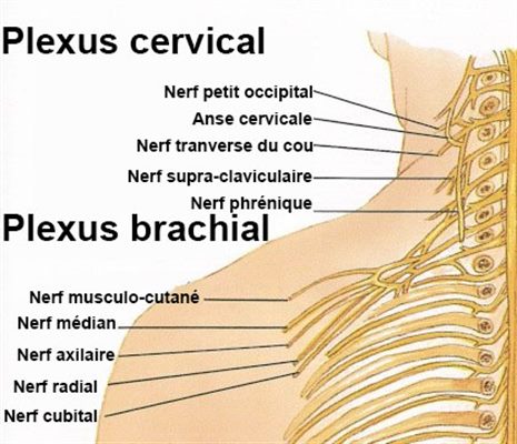 Névralgie cervico-brachiale