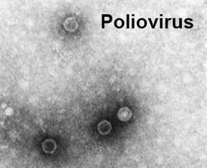 poliovirus