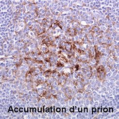 prion