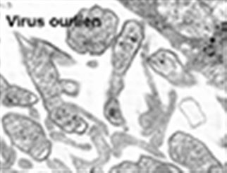 virus ourlien