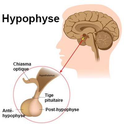 Tumeurs de l'hypophyse