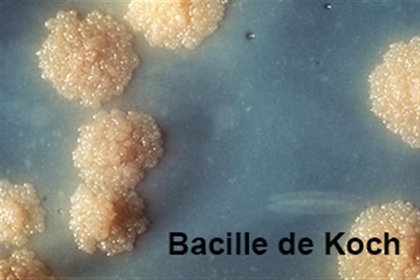 Bacille de Koch