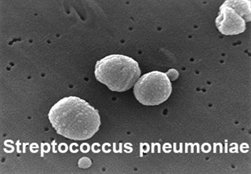 streptococcus peneumoniae