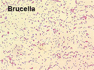 brucella spp