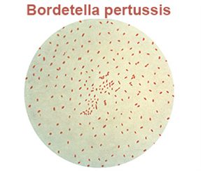 bordetella pertussis