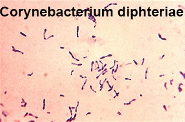 Corynebacterium diphteriae