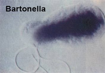 bartonella