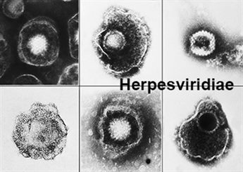 herpes viridae