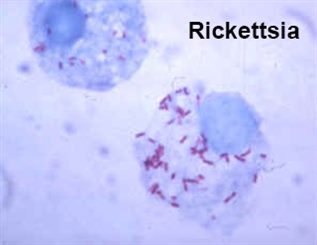 Rickettsioses : symptômes, traitement, définition - docteurclic.com