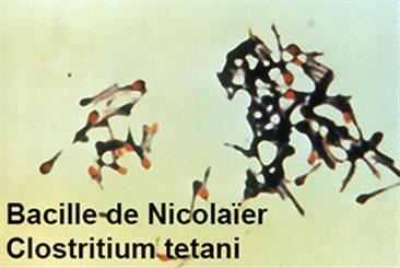 bacille de Nicolaïer