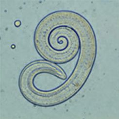 trichinella spiralis