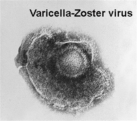 Zona ophtalmique