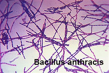 bacillus anthracis
