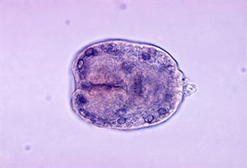 ecchinicoccus granulosus