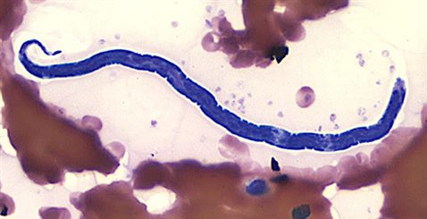 filaris loa