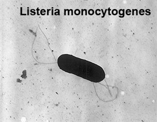 listeria monocytogenes