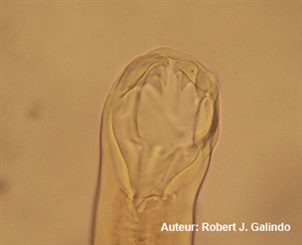 ancilostoma duodenale