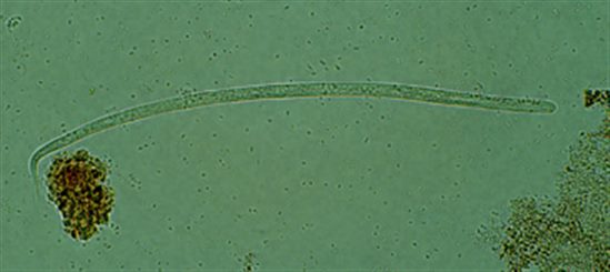 onchocerca volvulus