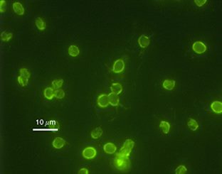 cryptosporidium parvum
