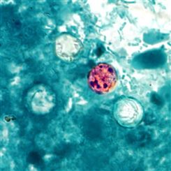 cyclospora cayetanensis