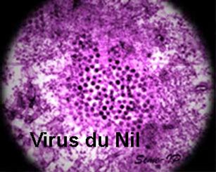 virus du Nil
