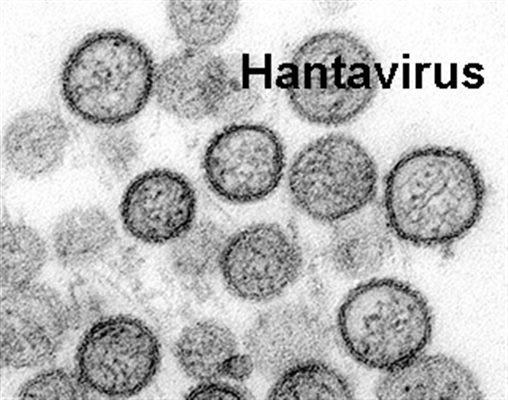 Hantavirus