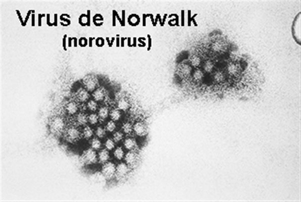 Infections à norovirus